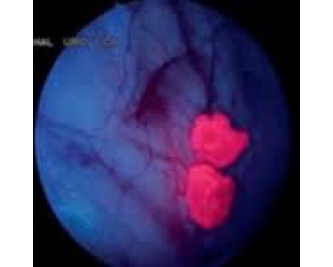 Urologue Taza