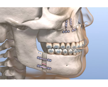 Chirurgien Esthetique et maxillo-facial