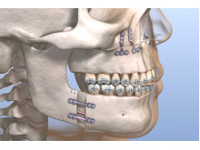 chirurgien Esthetique et maxillo-facial