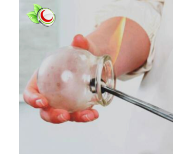 الحجامة - مركز ابن سينا