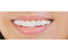 Centre invisalign Casablanca