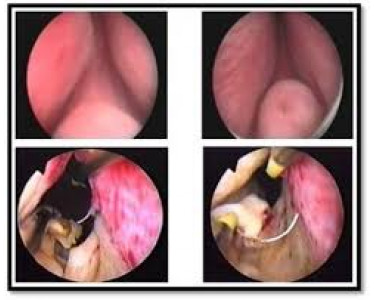 Urologue Taza